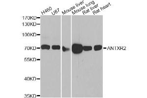 Western blot analysis of extracts of various cell lines, using ANTXR2 antibody (ABIN2561129) at 1:1000 dilution. (ANTXR2 抗体)