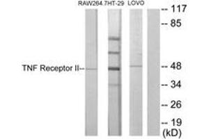 Western blot analysis of extracts from RAW264. (TNFRSF1B 抗体  (AA 376-425))