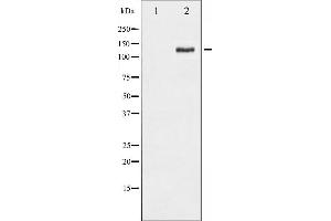 Western blot analysis of FAK phosphorylation expression in PMA treated HepG2 whole cell lysates,The lane on the left is treated with the antigen-specific peptide. (FAK 抗体  (pSer843))