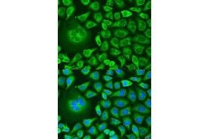 Immunofluorescence analysis of U2OS cells using UBIAD1 antibody (ABIN6293617) at dilution of 1:100. (UBIAD1 抗体)