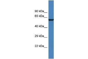 Western Blotting (WB) image for anti-Adhesion Molecule with Ig-Like Domain 2 (AMIGO2) (N-Term) antibody (ABIN2156368) (AMIGO2 抗体  (N-Term))