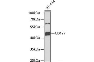 Western blot analysis of extracts of BT-474 cells using CD177 Polyclonal Antibody at dilution of 1:1000. (CD177 抗体)