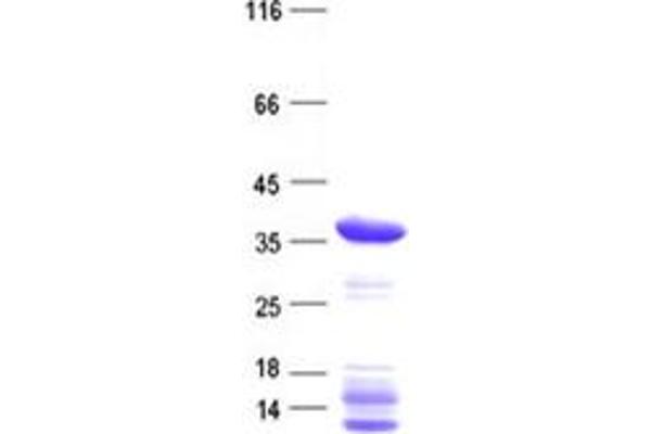 CDKL4 Protein (His tag)