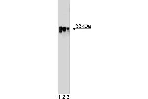 Western blot analysis of LSF on a HCT-8 cell lysate (Human colorectal adenocarcinoma, ATCC CCL-244). (TFCP2 抗体  (AA 205-414))