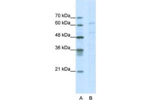 Western Blotting (WB) image for anti-Calcium Channel, Voltage-Dependent, beta 3 Subunit (CACNB3) antibody (ABIN2461082) (CACNB3 抗体)