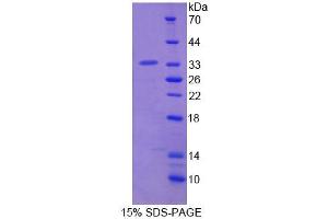 SDS-PAGE (SDS) image for Lymphocyte-Specific Protein 1 (LSP1) (AA 126-330) protein (His tag) (ABIN4989369) (LSP1 Protein (AA 126-330) (His tag))