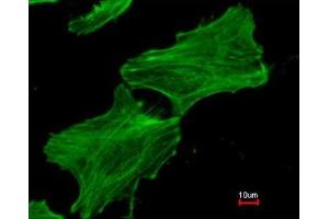 Immunofluorescence analysis of methanol-fixed HeLa, using Beta actin antibody at 1:300 dilution. (beta Actin 抗体)