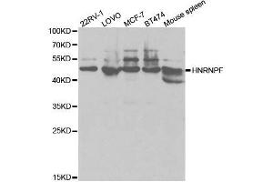 Western blot analysis of extracts of various cell lines, using HNRNPF antibody. (HNRNPF 抗体  (AA 1-280))