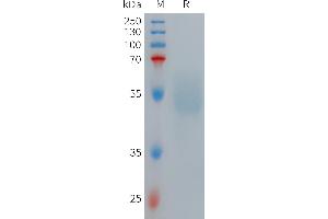 Human R Protein, hFc Tag on SDS-PAGE under reducing condition. (GLP1R Protein (AA 24-139) (Fc Tag))