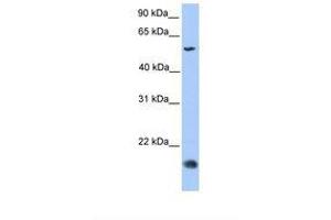 Image no. 1 for anti-CKLF-Like MARVEL Transmembrane Domain Containing 8 (CMTM8) (C-Term) antibody (ABIN6739410) (CMTM8 抗体  (C-Term))