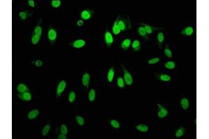 Immunofluorescence staining of Hela cells with ABIN7127304 at 1:60,counter-stained with DAPI. (Recombinant HIST1H3A 抗体  (H3R2me))