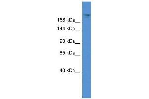 Western Blot showing TPR antibody used at a concentration of 1 ug/ml against 721_B Cell Lysate (TPR 抗体  (C-Term))