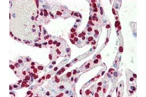 Immunohistochemistry of Histone H3 antibody Tissue: Lung Fixation: formalin fixed paraffin embedded Antigen retrieval: user optimized Primary antibody:  Histone H3 antibody 1:100 Secondary antibody: Peroxidase goat anti-rabbit at 1:10,000 for 45 min at RT Image provided courtesy of Andrew Elston, LifeSpan BioSciences, Inc. (Histone 3 抗体  (C-Term))