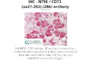 Image no. 1 for anti-5'-Nucleotidase, Ecto (CD73) (NT5E) (AA 27-252) antibody (ABIN1723204) (CD73 抗体  (AA 27-252))