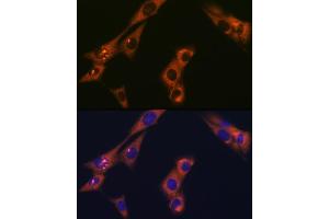 Immunofluorescence analysis of NIH-3T3 cells using  Rabbit mAb (ABIN1681069, ABIN3018897, ABIN3018898 and ABIN7101684) at dilution of 1:100 (40x lens). (alpha Adaptin 抗体)