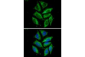 ICC/IF analysis of Tomm20 in HeLa cells. (TOMM20 抗体)