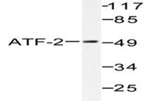 Image no. 1 for anti-Activating Transcription Factor 2 (ATF2) antibody (ABIN265318) (ATF2 抗体)