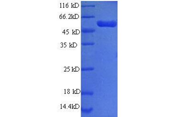 PHGDH Protein (AA 2-251, partial) (GST tag)