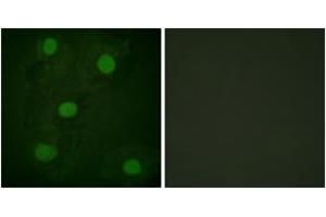 Immunofluorescence analysis of HeLa cells, using p53 (Ab-317) Antibody. (p53 抗体  (AA 283-332))