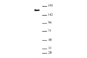 SMC4 antibody (pAb) tested by Western blot Nuclear extract of HeLa cells (20 μg) probed with SMC4 antibody (1:1,000). (SMC4 抗体  (N-Term))