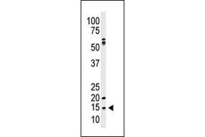 Western blot analysis of anti-SUMO1 polyclonal antibody (ABIN1882137 and ABIN2845494) in  cell line lysate. (SUMO1 抗体  (N-Term))