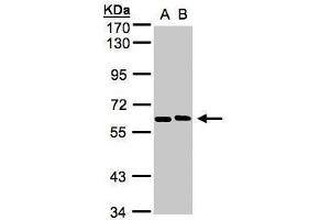 WB Image Sample(30 ug whole cell lysate) A:H1299 B:HeLa S3, 7. (NT5C2 抗体)