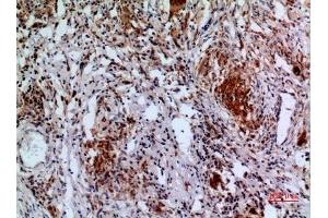 Immunohistochemical analysis of paraffin-embedded human-lung, antibody was diluted at 1:100. (APAF1 抗体  (Internal Region))