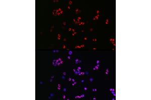 Immunofluorescence analysis of F9 cells using [KO Validated] SOX2 Rabbit pAb (ABIN3021002, ABIN3021003, ABIN3021004 and ABIN6213889) at dilution of 1:50 (40x lens). (SOX2 抗体  (AA 1-140))