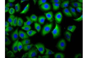 Immunofluorescence staining of A549 cells with ABIN7158551 at 1:66, counter-stained with DAPI. (FCGR3B 抗体  (AA 18-125))