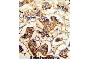 Immunohistochemistry (IHC) image for anti-Actinin, alpha 4 (ACTN4) antibody (ABIN3003494) (alpha Actinin 4 抗体)