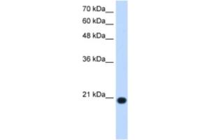 Western Blotting (WB) image for anti-Ubiquitously-Expressed, Prefoldin-Like Chaperone (UXT) antibody (ABIN2463113) (UXT 抗体)