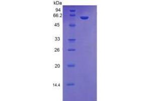 SDS-PAGE (SDS) image for Mannose-Binding Lectin (Protein C) 2, Soluble (MBL2) ELISA Kit (ABIN6574278)