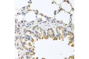 Immunohistochemistry of paraffin-embedded mouse lung using Bax antibody (ABIN5970040) at dilution of 1/100 (40x lens). (BAX 抗体)