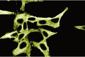 Immunofluorescence staining of HeLa cells. (PKA RIIalpha (AA 1-404) 抗体)