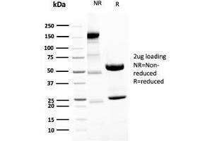 SDS-PAGE (SDS) image for anti-Neurofilament, Heavy Polypeptide (NEFH) antibody (ABIN6940186)