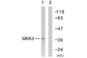 Western blot analysis of extract from MDA-MB-435 cells, using MKK3 (Ab-189) antibody (E021116). (MAP2K3 抗体)
