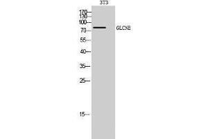 Western Blotting (WB) image for anti-Glucosamine (UDP-N-Acetyl)-2-Epimerase/N-Acetylmannosamine Kinase (GNE) (C-Term) antibody (ABIN3175276) (GNE 抗体  (C-Term))