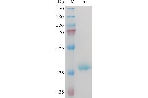 Mouse Protein, hFc Tag on SDS-PAGE under reducing condition. (IGF1 Protein (Fc Tag))