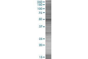 ANXA11 transfected lysate. (ANXA11 293T Cell Transient Overexpression Lysate(Denatured))