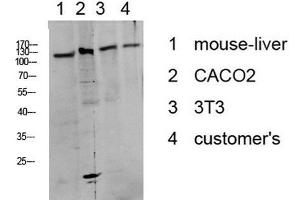 Western Blot analysis of various cells using Phospho-DDR1 (Tyr513) Polyclonal Antibody at dilution of 1:1000. (DDR1 抗体  (pTyr513))