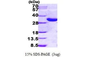 HSD17B14 Protein (AA 1-270) (His tag)