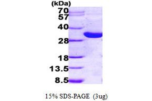 HSD17B14 Protein (AA 1-270) (His tag)