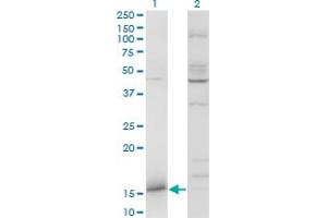 Western Blot analysis of IFITM3 expression in transfected 293T cell line by IFITM3 monoclonal antibody (M02), clone 2H4-1D5. (IFITM3 抗体  (AA 1-133))