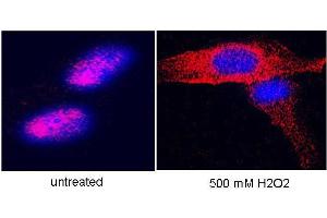 Anti-hTERT Antibody - Immunofluorescence Microscopy  anti hTERT antibody-Immunofluorescence# anti hTERT antibody was used to stain hTERT on hTERT-over-expressing fibroblasts. (TERT 抗体  (C-Term))