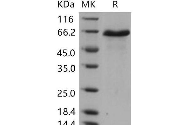 DLL1 Protein (His tag)