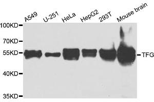 Western blot analysis of extracts of various cell lines, using TFG antibody (ABIN5975639) at 1/1000 dilution. (TFG 抗体)