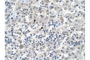 CDR2 antibody was used for immunohistochemistry at a concentration of 4-8 ug/ml. (CDR2 抗体  (N-Term))