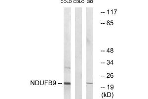 Western blot analysis of extracts from COLO cells and 293 cells, using NDUFB9 antibody. (NDUFB9 抗体  (Internal Region))