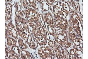 Image no. 1 for anti-Parvin, alpha (PARVA) antibody (ABIN1496441) (Parvin alpha 抗体)