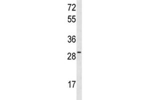 Western blot analysis of HES6 antibody and MCF-7 lysate. (HES6 抗体  (AA 6-34))